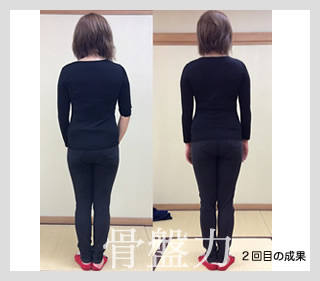 ビフォーアフター