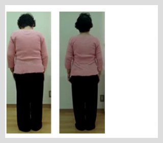 ビフォーアフター