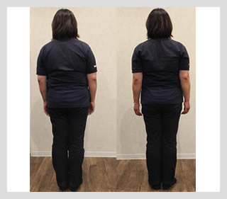 ビフォーアフター