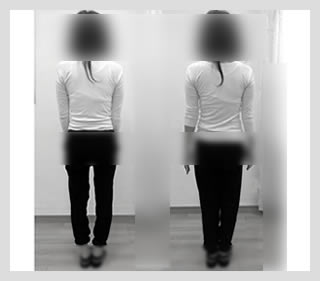 ビフォーアフター