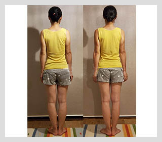 ビフォーアフター