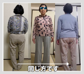 ビフォーアフター