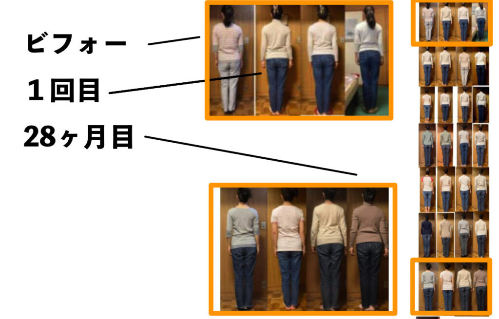 ビフォーアフター